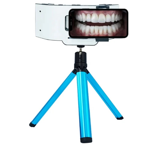Mobile Attachment Dental Photography Light